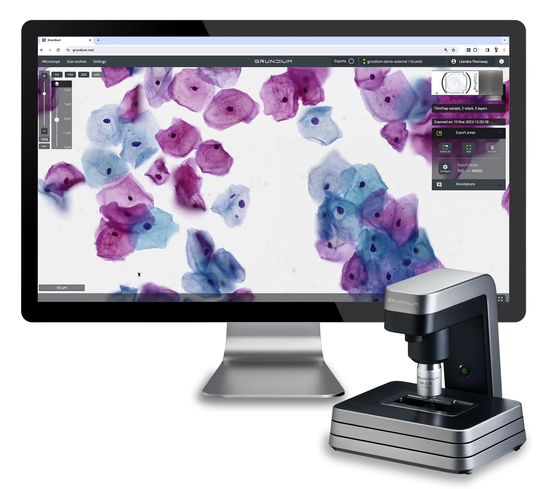 Grundium Ocus 40 digital pathology scanner and a computer displaying a cytology sample