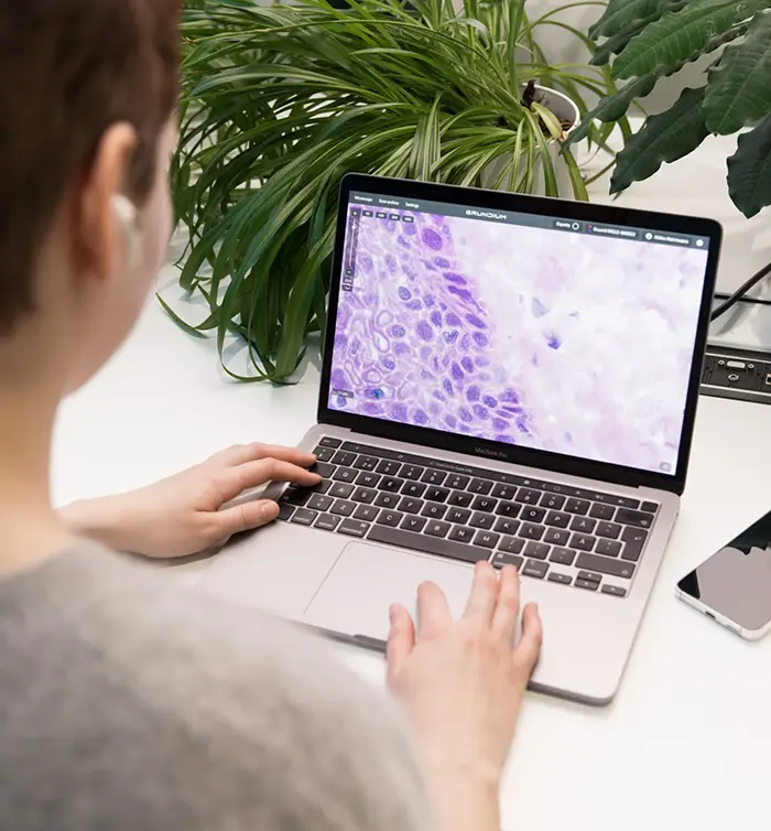 A pathologist looking at a Ocus-scanned sample remotely on her laptop