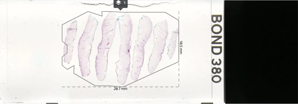 Ocus20 scan sample image 327