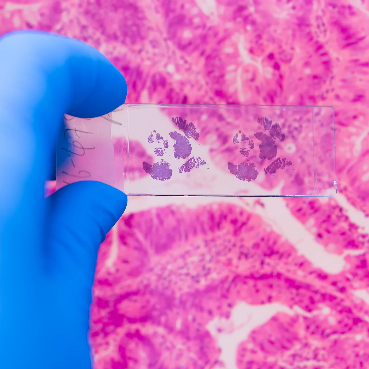 Improving tissue sample quality: How digital pathology supports accurate histology