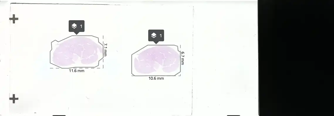 Frozen section sample, liver