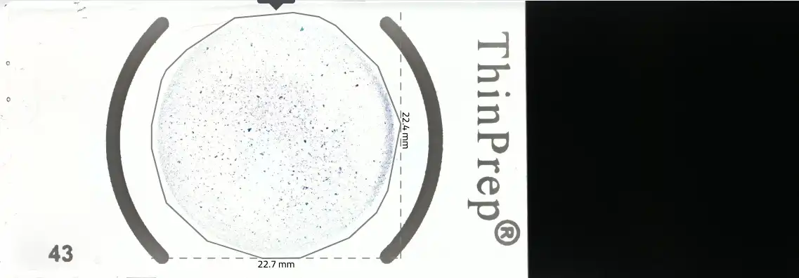 Ocus40 Thinprep sample