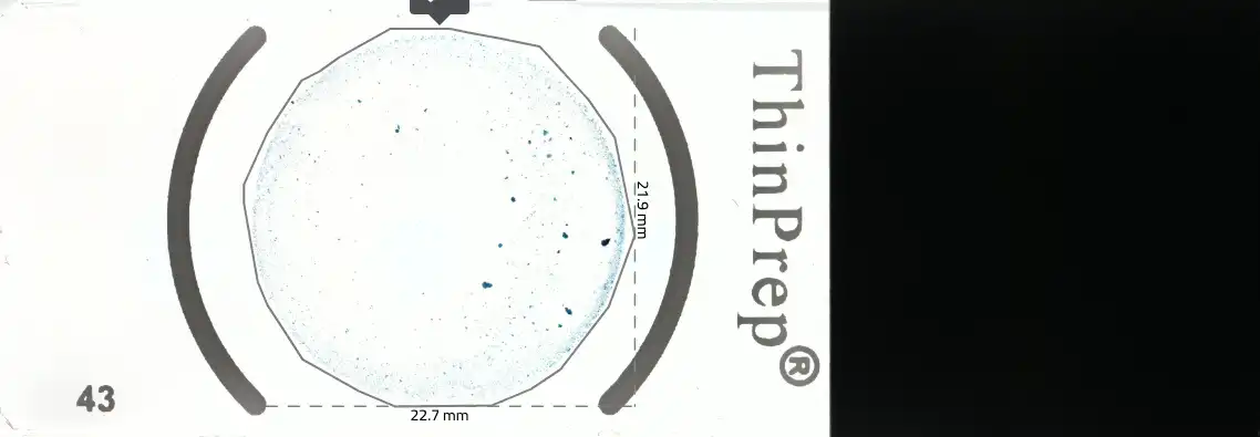 Ocus40 thin prep sample